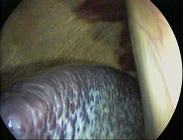 Horse_spleen_laparoscopic.jpg