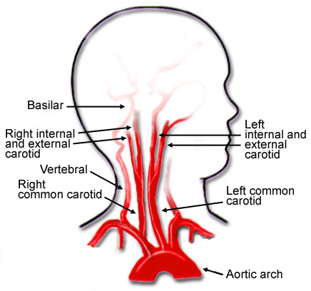 cervicocerebral-arteries.jpg
