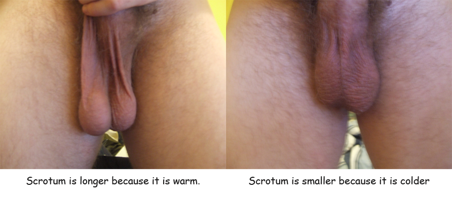 Scrotum.png