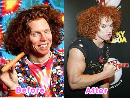 carrot-top-plastic-surgery.jpg